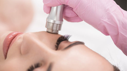 Microdermabrasion 1-1 - Warwick